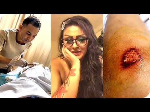 سميرة الداودي في المستشفى بعد تعرّضها لحروق في رجلها