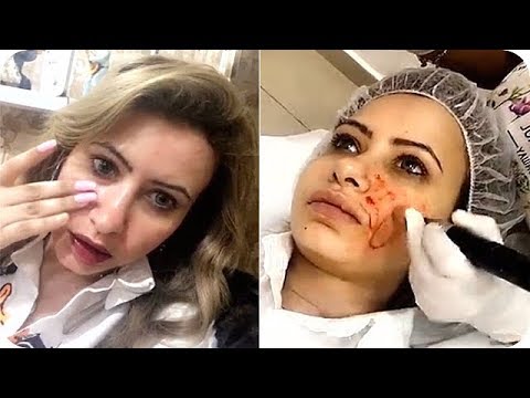 مي العيدان في جلسة تنظيف البشرة