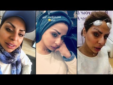 هند البلوشي تكمل علاج حواجبها عند الدكتور بعد ما شالت الزراعه 