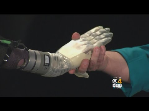 ابتكار ذراع اصطناعي كامل يتحرك مع إشارات العضلات