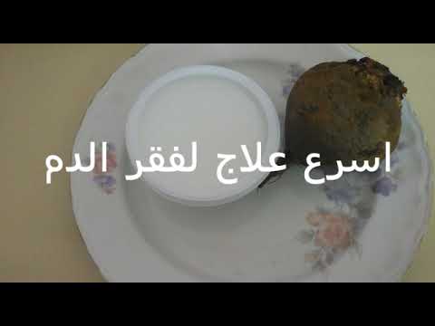 علاج الأنيميا في 3 أيام
