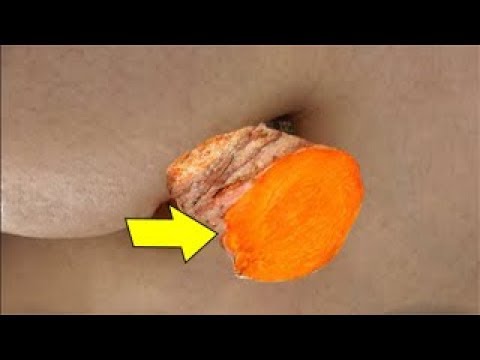 بالفيديو أسعدي زوجك كل ليلة بتبييض المناطق الحساسة بالفيديو أسعدي زوجك كل ليلة بتبييض المناطق الحساسة