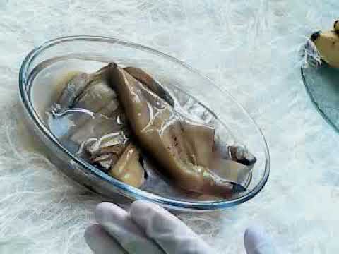 تعرف على علاج الضغط المرتفع وآلام الرأس