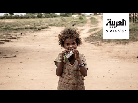ملايين طفل سيعانون سوء التغذية الحادة بسبب كورونا
