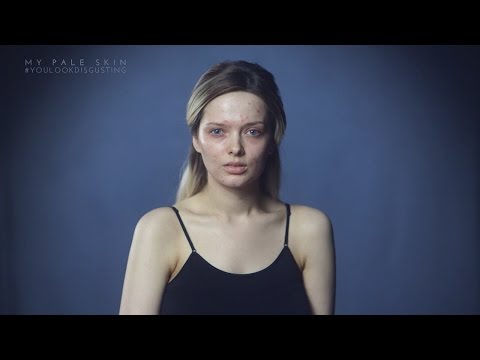 شاهد فتاة بريطانية تواجه الانتقادات لبشرة وجهها