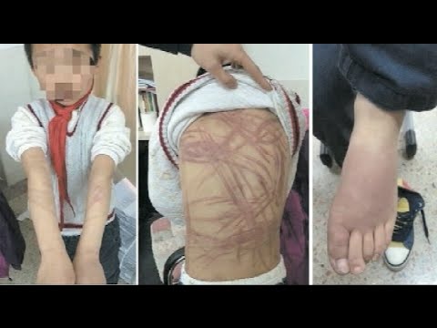 أم تضرب ابنها بسوط وتشوه جسده