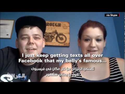 امرأة تكتشف أنَّها حامل بعد قبلة من قرد