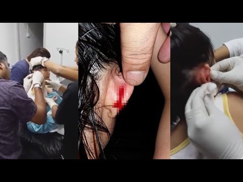 معلم ماليزى يعاقب تلميذة بقطع جزء من أذنها